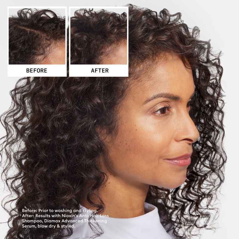 Nioxin Anti-Hairloss Shampoo 475 ml