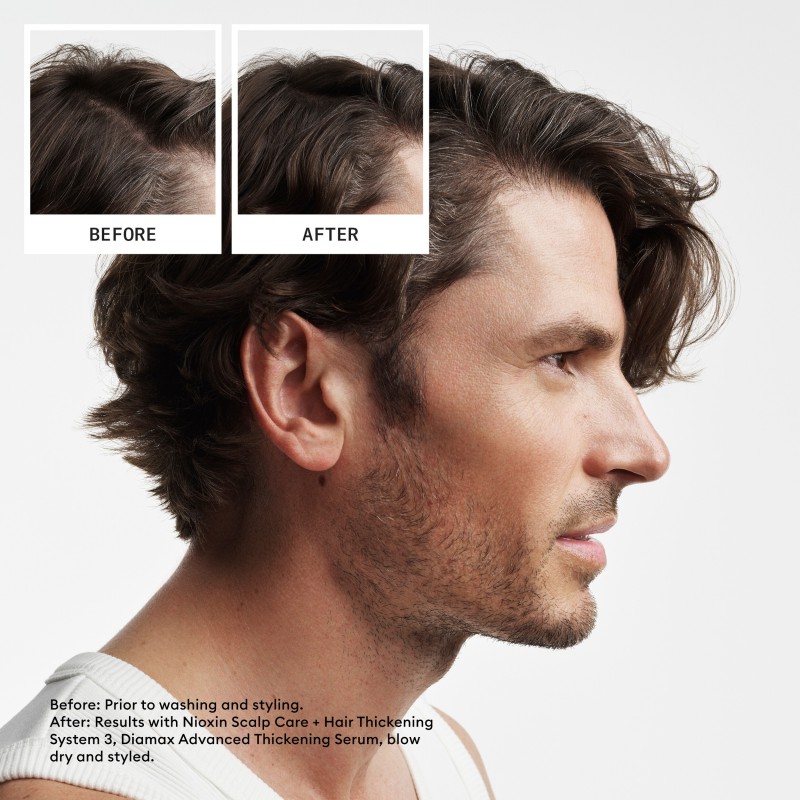 Nioxin System 2 Loyalty Kit for Thinning Hair