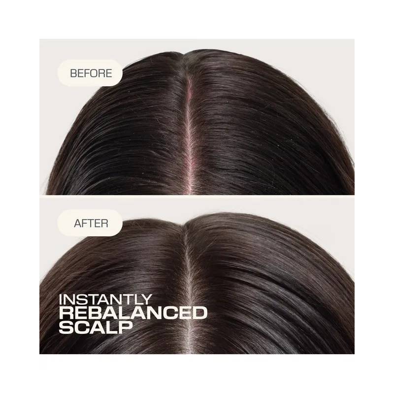 Goldwell Dualsenses Scalp Specialist Rebalance & Hydrate Fluid 150 ml - Hårbottenbehandling