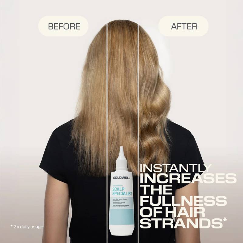 Goldwell Dualsenses Scalp Specialist Anti-Hair Loss Serum 150 ml